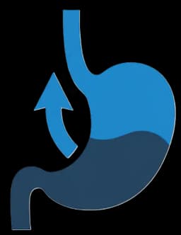 Reflujo Gastroesofático